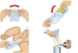 راهنمای نمونه گیری ادرار در کودکان