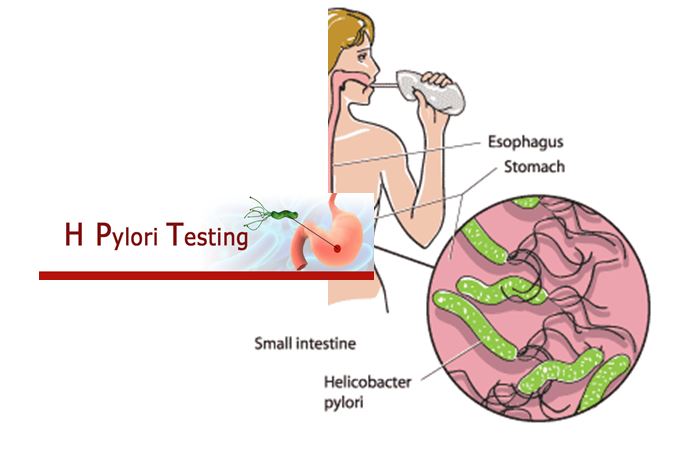 تست تنفسی اوره